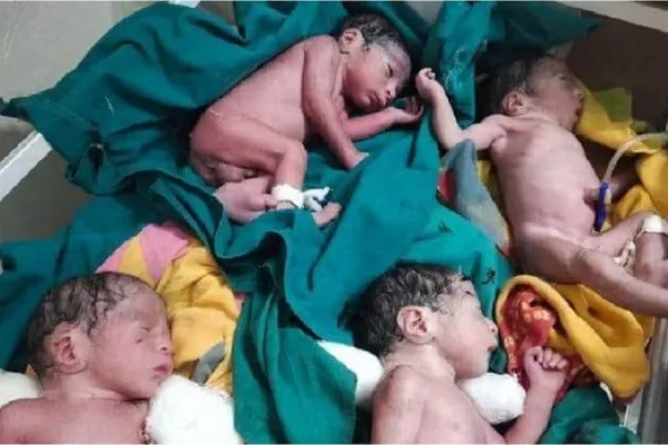 ஒரே பிரசவத்தில் 2 பெண் குழந்தைகள் 2 ஆண் குழந்தைகள் பிறந்துள்ளது..! இதில் 3 குழந்தைகள் கண்காணிப்பில் உள்ளது…