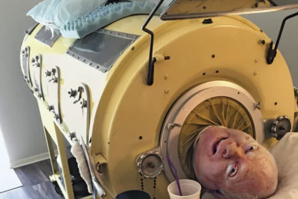 இரும்பு நுரையீரலுடன் 7 தசாப்தங்களுக்கு மேல் வாழ்ந்த நோயாளி!… கின்னஸ் உலக சாதனை!