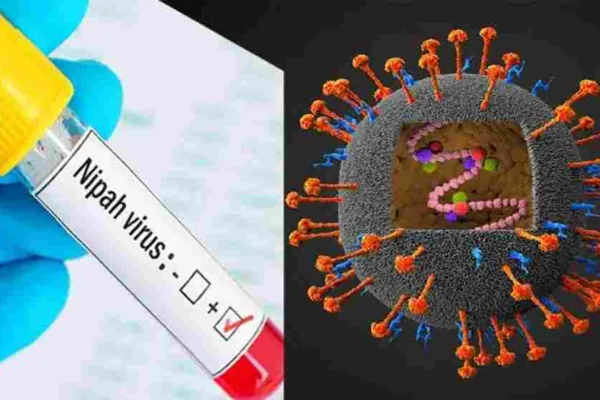 நிஃபா வைரஸ் இவ்வளவு மோசமானதா..? மக்களே எச்சரிக்கையா இருங்க..!!