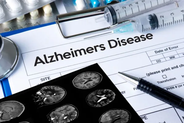 World Alzheimer's Day 2023: Tips To Prevent & Reduce the Risk of Alzheimer's