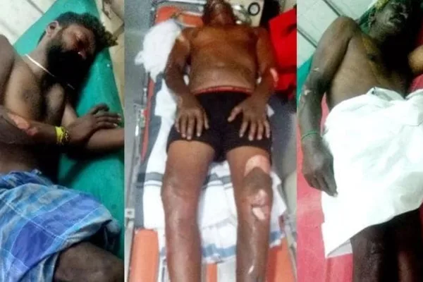 எச்சரிக்கை!!! இரவு முழுவதும் செல்போன் சார்ஜ் போட்டதால் நேர்ந்த விபரீதம்..