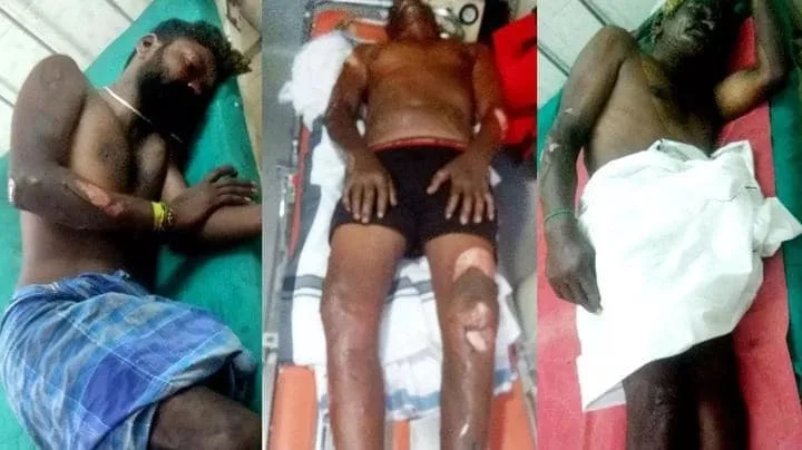 எச்சரிக்கை!!! இரவு முழுவதும் செல்போன் சார்ஜ் போட்டதால் நேர்ந்த விபரீதம்..