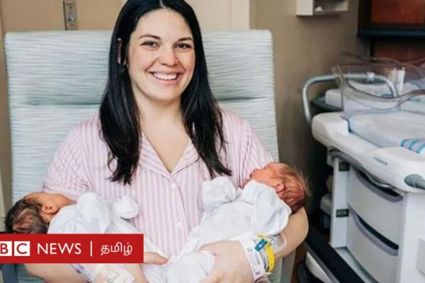 இரட்டை குழந்தை - சகோதர இரட்டையர் வேறுபாடு என்ன? அமெரிக்க பெண்ணுக்கு நடந்த அதிசயம்