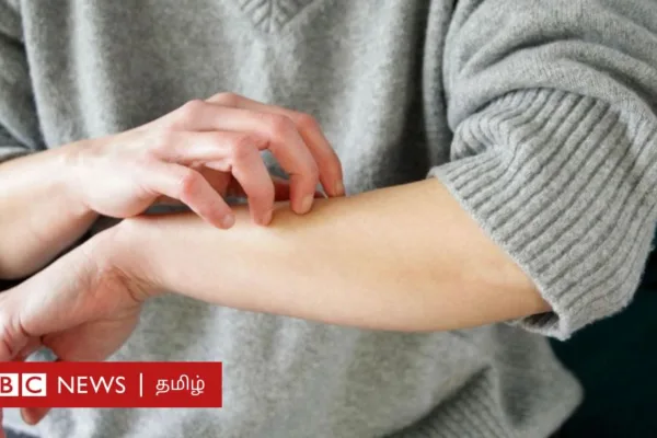 உடலில் நாள்பட்ட அரிப்பு ஏன் ஏற்படுகிறது? எப்படி குணப்படுத்துவது?