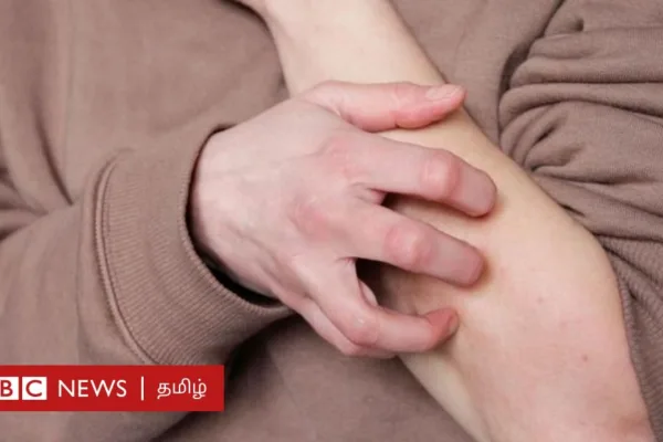 உடல் அரிப்பு: நாம் ஏன் சொறிந்து கொள்கிறோம்? கட்டுப்படுத்த முடியுமா?