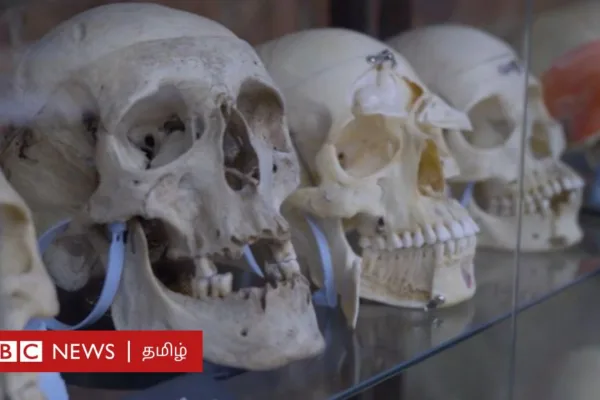 இந்திய வணிகர் கிடங்கில் மீட்ட 1,500 குழந்தைகளின் எலும்புக் கூடுகள் - மருத்துவ உலகை புரட்டிப்போட்டது எப்படி?